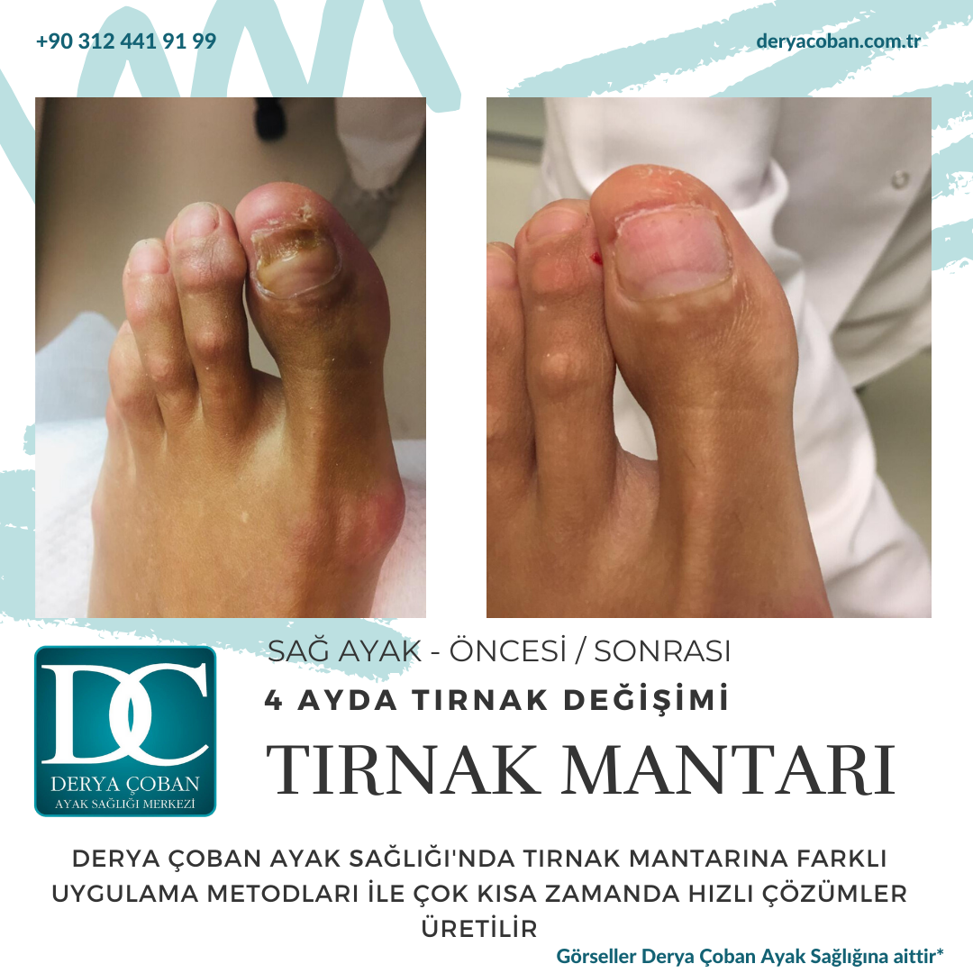 turnak mantarı